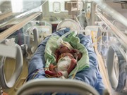 Bí ẩn cơn đau ở trẻ sơ sinh
