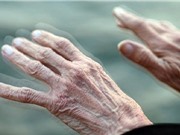 Mối liên hệ giữa COVID-19 và bệnh Parkinson