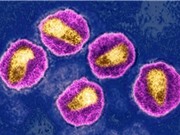 Tìm thấy biến thể HIV có độc lực cao hơn ở châu Âu