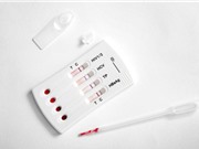 COVID thúc đẩy xu hướng tự xét nghiệm tại nhà để phát hiện bệnh giang mai