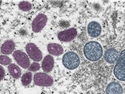 Đề xuất đổi tên chủng virus đậu khỉ để xóa bỏ kỳ thị địa lý