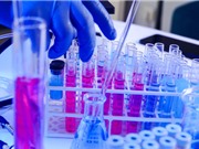 Trung Quốc báo cáo hàng chục ca nhiễm virus Langya mới và đang tiếp tục truy vết
