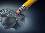 Thuốc Alzheimer mới: Có thật là một đột phá?