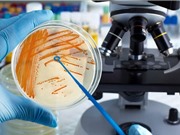 Xây dựng năng lực xét nghiệm vi sinh ở các cơ sở y tế