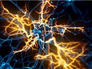 COVID-19 gây viêm não giống bệnh Parkinson