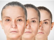 Giới tính quyết định hiệu quả sử dụng của thuốc chống lão hóa?