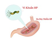 Quy trình phát hiện đột biến gene 23S rRNA và gyrA