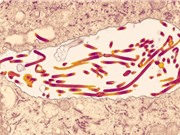 Thách thức cho việc thử nghiệm các vaccine Marburg 