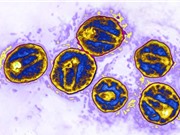Bệnh nhân thứ ba khỏi HIV sau khi được cấy ghép tế bào gốc kháng virus