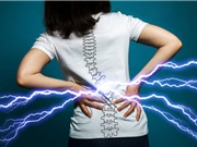 Hy vọng mới cho người bị đau lưng mãn tính