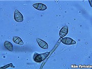 Sự đa dạng di truyền của các chủng nấm gây bệnh đạo ôn