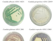 Phát hiện nhanh, chính xác nấm Candida bằng kỹ thuật multiplex PCR