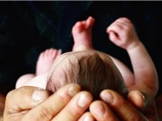 Chà dịch âm đạo của mẹ lên trẻ sinh mổ để khắc phục sự thiếu hụt những vi khuẩn quan trọng 