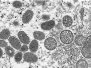 Anh mở rộng tiêm vaccine đậu mùa khỉ tại thủ đô London