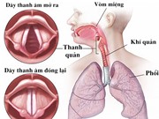 Giọng nói thay đổi khi chúng ta già đi