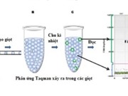 Ứng dụng PCR kỹ thuật số trong theo dõi điều trị bệnh bạch cầu mạn dòng tủy