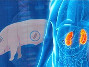 Nuôi cấy thận người bên trong phôi lợn đang phát triển