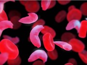 Anh phê duyệt liệu pháp gene điều trị các bệnh di truyền về máu