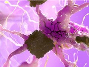 Liệu pháp thử nghiệm làm giảm triệu chứng bệnh Alzheimer ở chuột