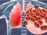 Số ca tử vong do nhiễm nấm trên toàn cầu tăng gấp đôi sau một thập kỷ