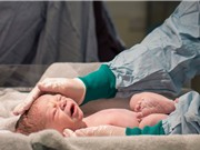 Biến đổi khí hậu làm tăng nguy cơ sinh non