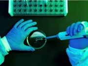 Phát hiện dấu hiệu của ung thư từ nhiều năm trước khi xuất hiện triệu chứng