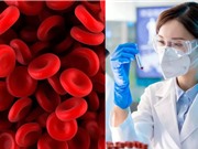 Phát hiện hệ thống nhóm máu mới