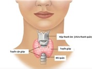 Loại thuốc phổ biến điều trị bệnh suy giáp, có thể làm tăng nguy cơ mất xương ở người lớn tuổi