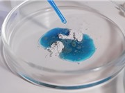Công nghệ mới giúp liệu pháp di truyền có thể điều trị cho nhiều người hơn với mức chi phí thấp hơn