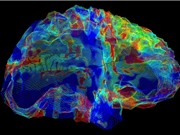 Một gene mạnh làm tăng nguy cơ mắc bệnh Alzheimer, Parkinson và các bệnh về não khác