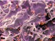 Vắc-xin HIV công nghệ mRNA kích hoạt phản ứng miễn dịch mạnh ở người
