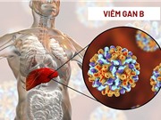 Nguy cơ khó loại trừ bệnh viêm gan B tại Việt Nam vào năm 2030
